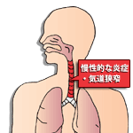 気管支に起こること